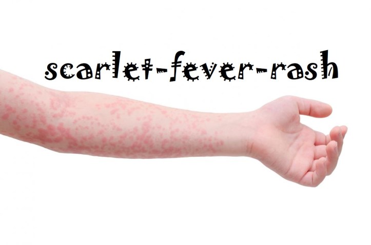 scarlet-fever